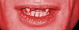 Teeth
