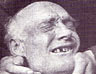 Long before the days of political correctness, Thomas Murphy, rather than 'follicly and dentally challenged', was described as being 'very bald with very bad teeth'.