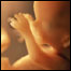 Feto (foto: Dopamine/Science Photo Library)