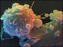 Dendritic cells.